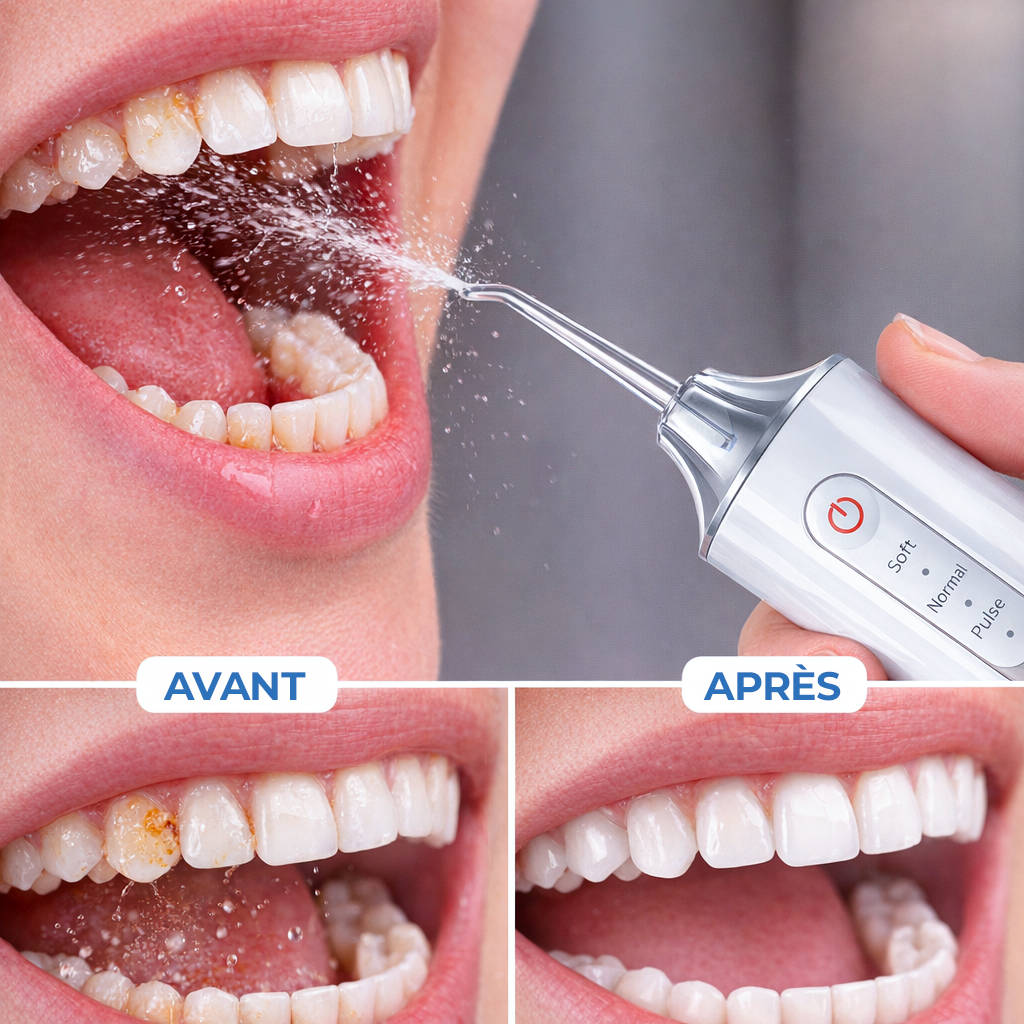Irrigateur Buccal Portable – Nettoyage Profond & Gencives Sublimées